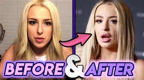 tana mongeau before and after.